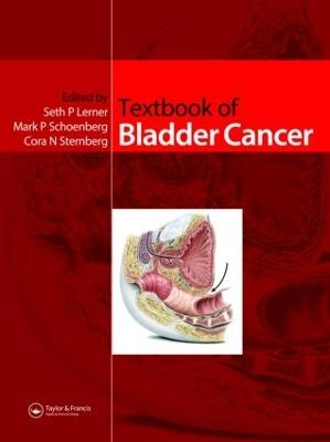 Textbook of Bladder Cancer - 