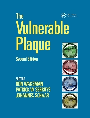 Handbook of the Vulnerable Plaque - 