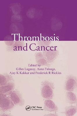 Thrombosis and Cancer - 