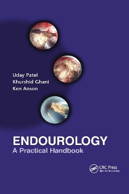 Endourology - 