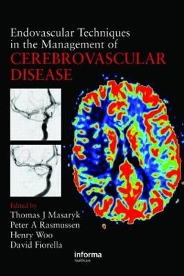 Endovascular Techniques in the Management of Cerebrovascular Disease - 