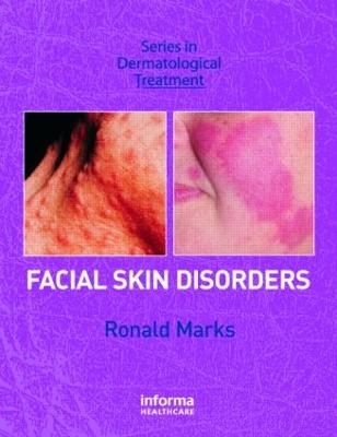 Facial Skin Disorders - Ronald Marks