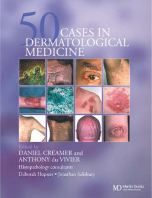 Fifty Dermatological Cases - Daniel Creamer, Anthony du Vivier