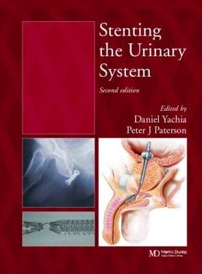 Stenting the Urinary System - Daniel Yachia, Peter J. Paterson