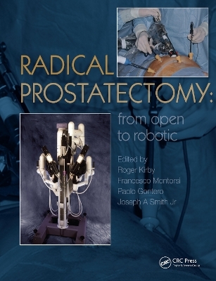 Radical Prostatectomy - 