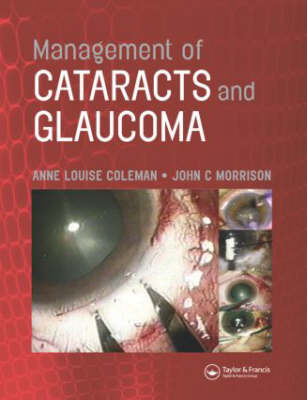 Management of Cataracts and Glaucoma - 