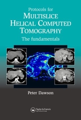 Protocols for Multislice Helical Computed Tomography - DAWSON PETER