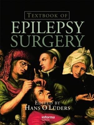 Textbook of Epilepsy Surgery - 