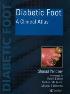 Diabetic Foot - Sharad Pendsey