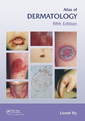 Atlas of Dermatology, Fifth Edition - Lionel Fry