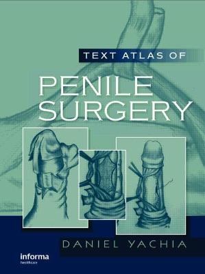 Text Atlas of Penile Surgery - Daniel Yachia