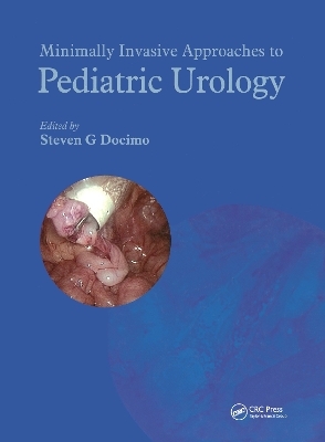 Minimally Invasive Approaches to Pediatric Urology - 