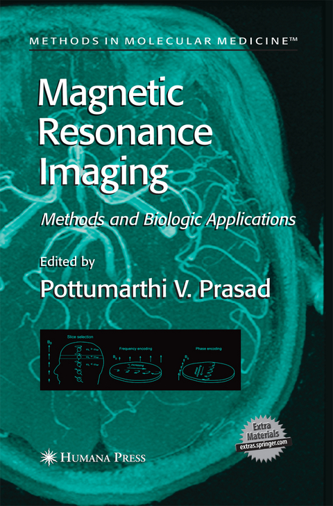 Magnetic Resonance Imaging - 