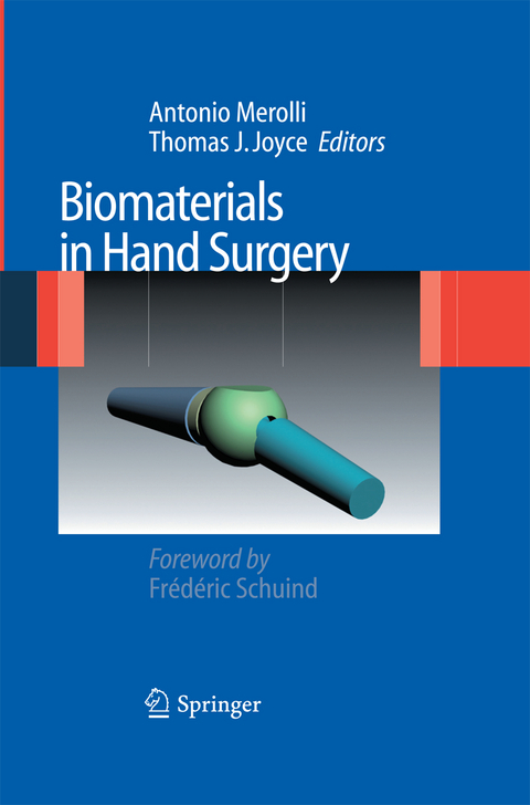 Biomaterials in Hand Surgery - 