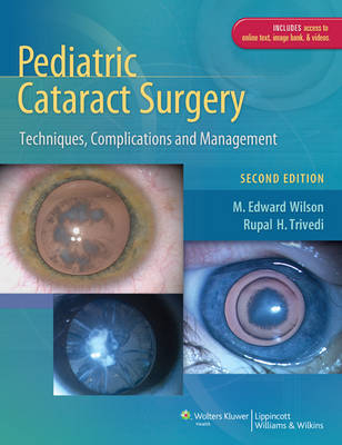 Pediatric Cataract Surgery -  Rupal H. Trivedi,  M. Edward Wilson