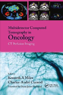 Multi-Detector Computed Tomography in Oncology - 