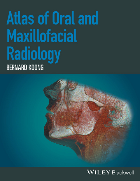 Atlas of Oral and Maxillofacial Radiology - Bernard Koong