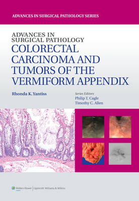 Advances in Surgical Pathology: Colorectal Carcinoma and Tumors of the Vermiform Appendix -  Rhonda Yantiss