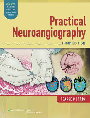 Practical Neuroangiography -  P. Pearse Morris