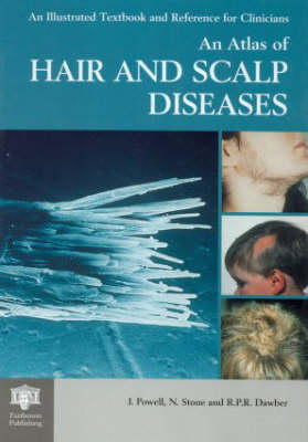 An Atlas of Hair and Scalp Diseases - Jennifer Powell, Natalie Stone, Rodney P.R. Dawber