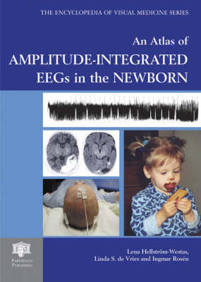 An Atlas of Amplitude-Integrated EEGs in the Newborn, Second Edition, with DVD - Lena Hellström-Westas