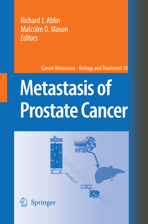 Metastasis of Prostate Cancer - 