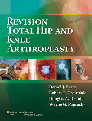 Revision Total Hip and Knee Arthroplasty -  Daniel J. Berry