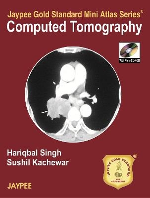 Jaypee Gold Standard Mini Atlas Series of Computed Tomography - Hariqbal Singh