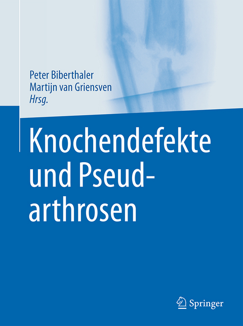 Knochendefekte und Pseudarthrosen - 