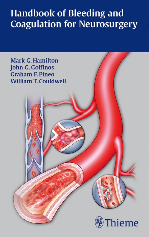 Handbook of Bleeding and Coagulation for Neurosurgery - 