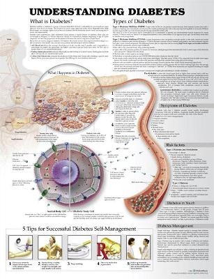 Understanding Diabetes Anatomical Chart -  Anatomical Chart Company, Jeff Unger