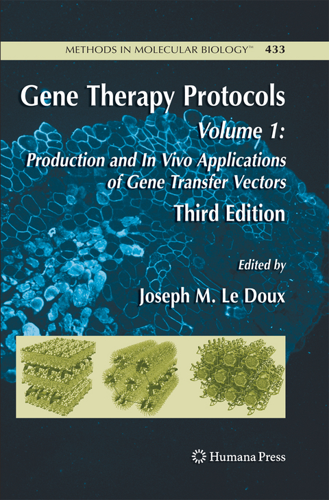 Gene Therapy Protocols - 