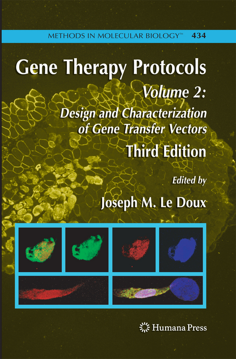 Gene Therapy Protocols - 