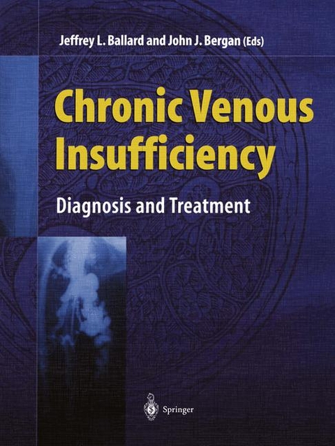 Venous Insufficiency - 