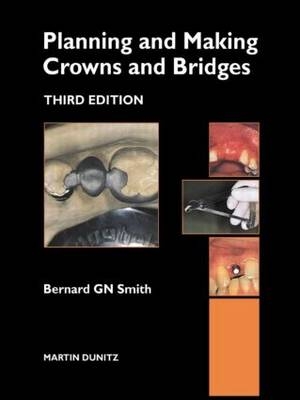 Planning and Making Crowns and Bridges - Bernard Gn Smith