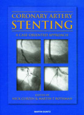 Coronary Artery Stenting - Nick Curzen, Martin T Rothman