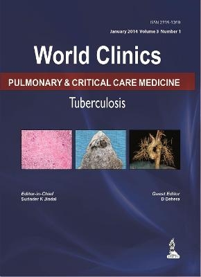 World Clinics: Pulmonary & Critical Care Medicine - Tuberculosis, Volume 3, No: 1 - Surinder K Jindal, D Behera