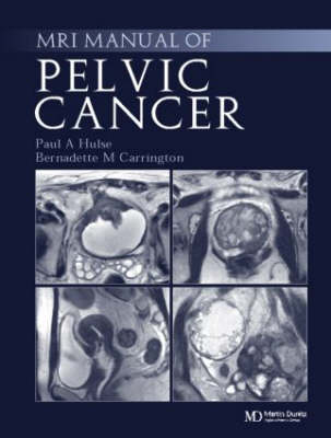 MRI Manual of Pelvic Cancer - 