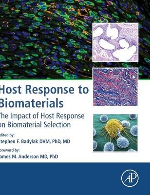 Host Response to Biomaterials - 