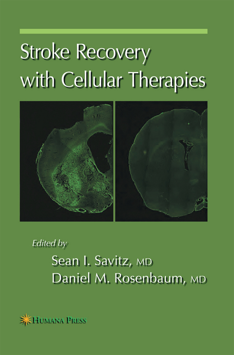 Stroke Recovery with Cellular Therapies - 