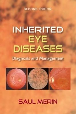 Inherited Eye Diseases - Saul Merin