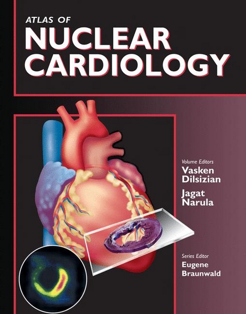 Atlas of Nuclear Cardiology - 