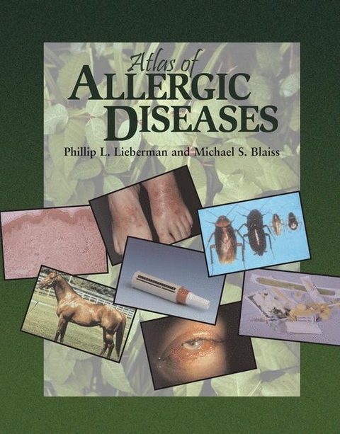 Atlas of Allergic Diseases - 