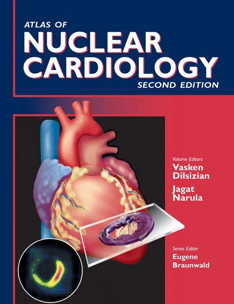 Atlas of Nuclear Cardiology - 