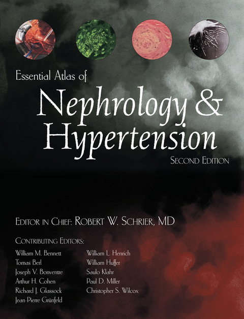 Essential Atlas of Nephrology & Hypertension - 