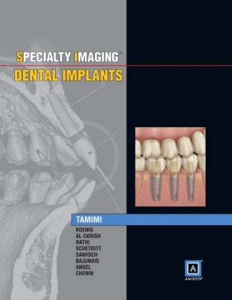 Specialty Imaging: Dental Implants - Dania Faisal Tamimi