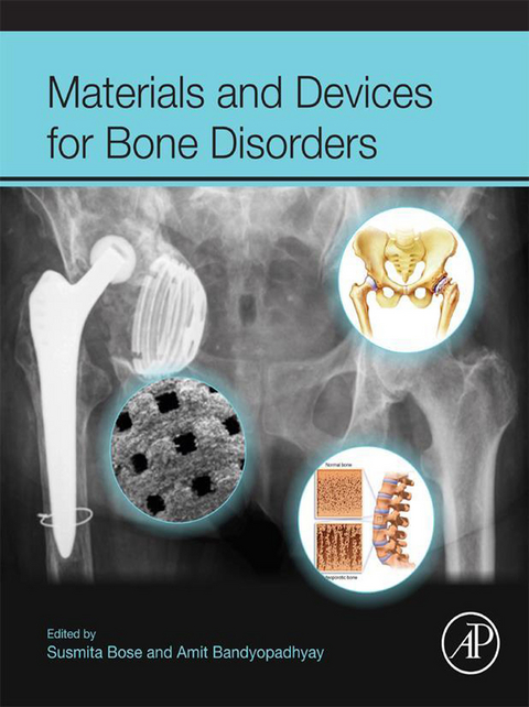 Materials and Devices for Bone Disorders - 