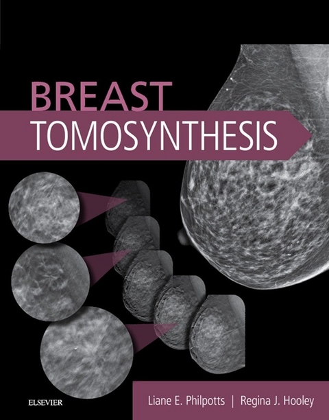 Breast Tomosynthesis E-Book -  Regina J Hooley,  Liane E Philpotts