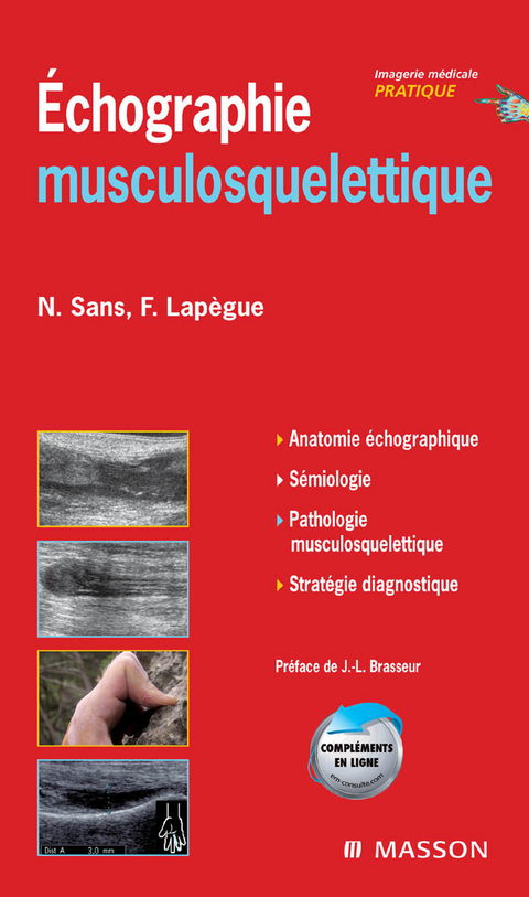 Echographie musculosquelettique -  Franck Lapegue,  Nicolas Sans