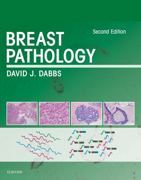 Breast Pathology E-Book -  David J Dabbs